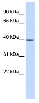 MAT2B Antibody (aa35-84)
