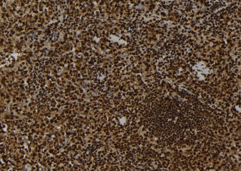 Polyclonal Rabbit anti-Human MAP3K9 / MLK1 Antibody (IHC, WB)