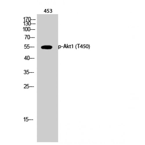 Polyclonal Rabbit anti-Human AKT1 Antibody (390-470 aa, IHC, WB)