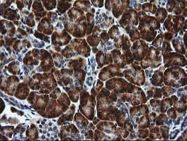 RGS16 Antibody (clone OTI1F3)