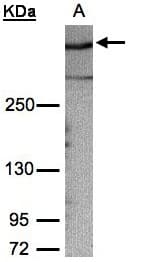 IHC-plus™ Polyclonal Rabbit anti-Human Gravin / AKAP12 Antibody (aa1719-1782, IHC, WB)