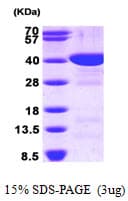Human FBP1 Protein (Recombinant His)
