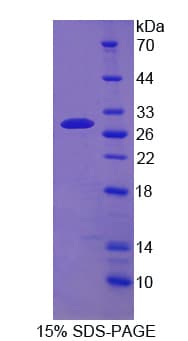 Human ABCC4 / MRP4 Protein (Recombinant His)
