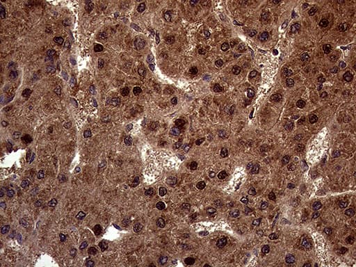 AMDHD1 Antibody (clone OTI2A8)