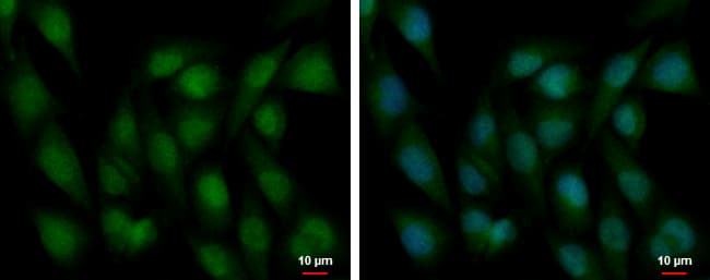 SIP1 Antibody (aa429-654)