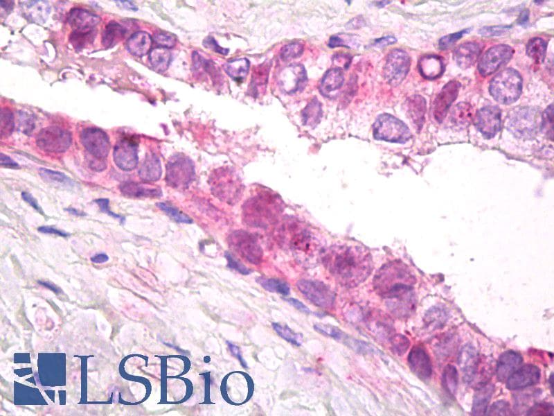 IHC-plus™ Polyclonal Rabbit anti-Human PSMD11 Antibody (aa288-317, IHC, WB)