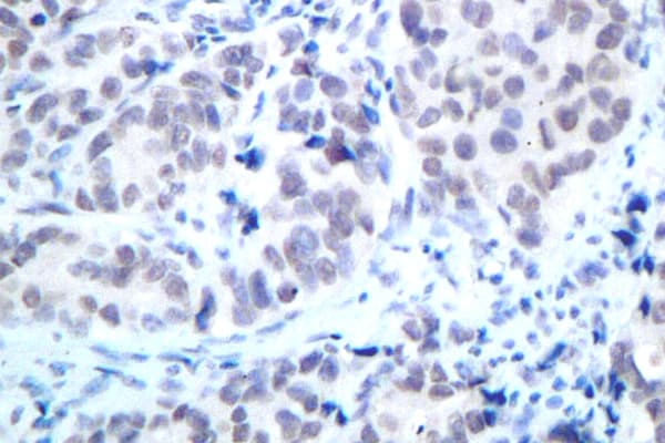 HDAC2 Antibody (Asp388)