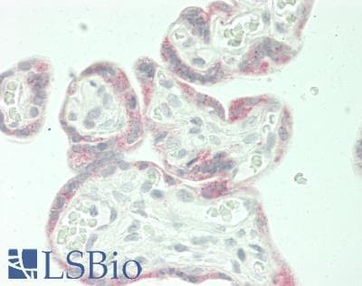 IHC-plus™ CHP2 Antibody (aa146-191)