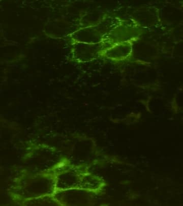 NOG / Noggin Antibody