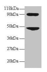 CCL7 / MCP3 Antibody