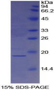 Human HP / Haptoglobin Protein (Recombinant His)