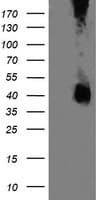 MAP2K3 / MEK3 / MKK3 Antibody (clone OTI6B12)