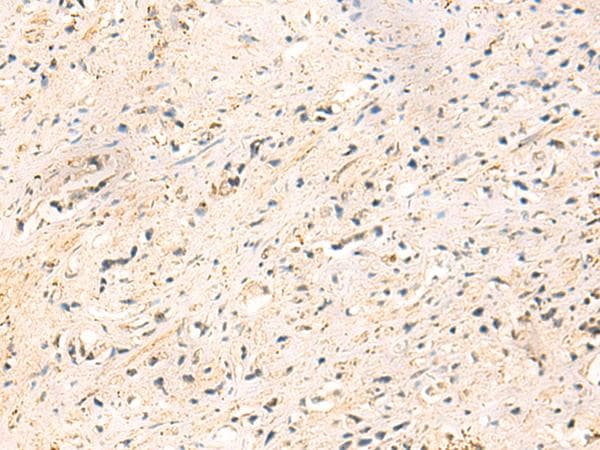 IP6K3 Antibody