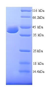 Human RAD23A / HHR23A Protein (Recombinant His)