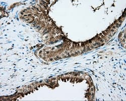 PRKAR2A Antibody (clone OTI4H8, Carrier-free)