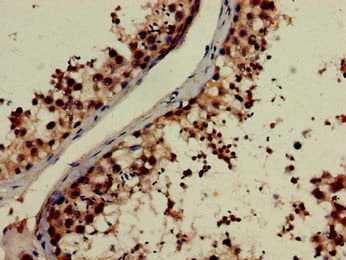Polyclonal Rabbit anti-Human NOG / Noggin Antibody (IHC)