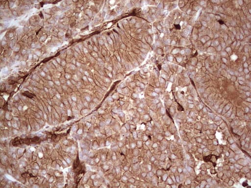 LGALS9 / Galectin 9 Antibody (clone OTI1D12)