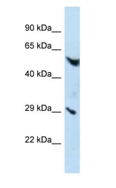 ADGRE3 / EMR3 Antibody (C-Terminus)