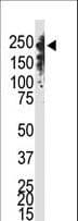 DNMT / DNMT1 Antibody (aa1588-1616)