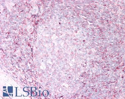 IHC-plus™ HLA-B Antibody