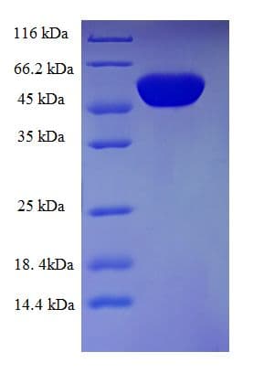 Human FCGRT / FCRN Protein (Recombinant GST, N-terminus)