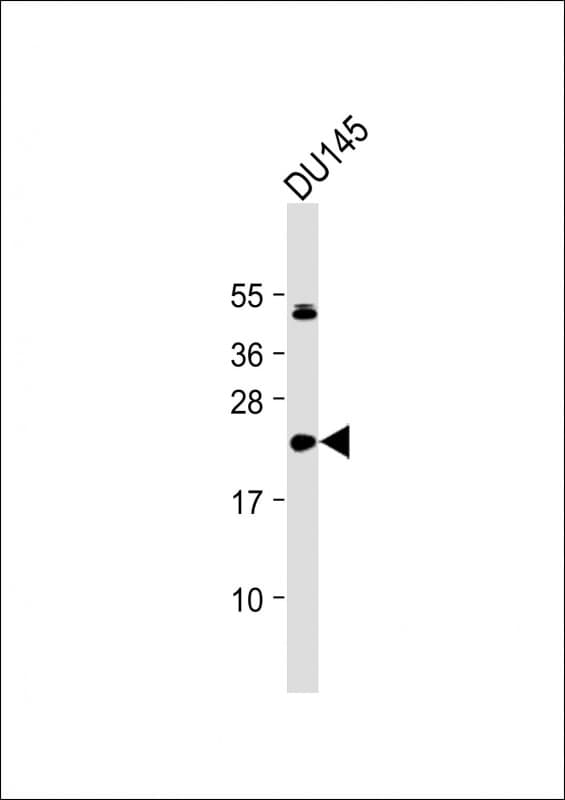 Polyclonal Rabbit anti-Human IL11 Antibody (N-Terminus, WB)