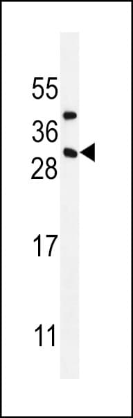 CD8B / CD8 Beta Antibody (aa141-167)