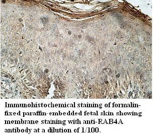 RAB4A / RAB4 Antibody (aa1-213)