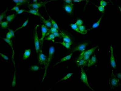 Polyclonal Rabbit anti-Human ARPC4 Antibody (IHC, IF)