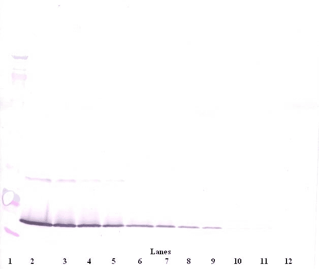Polyclonal Rabbit anti-Human IL21 Antibody (IHC, WB)