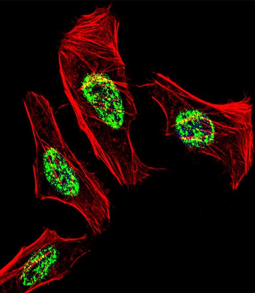 NR2C2 / TAK1 Antibody (aa438-466)
