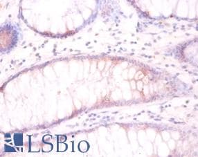 TUBB3 / Tubulin Beta 3 Antibody