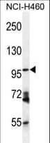 ENPEP / Aminopeptidase A Antibody (aa899-930)
