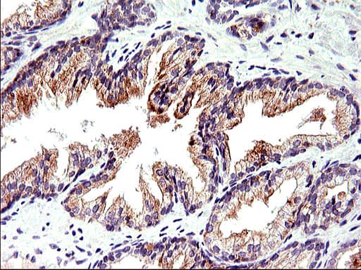 TOLLIP Antibody (clone OTI2A4)