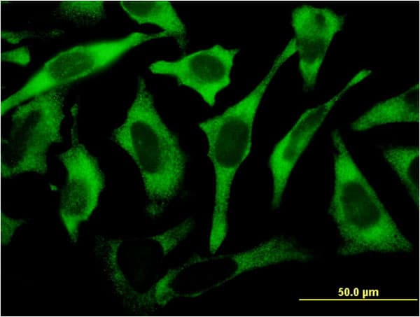 RPL17 / Ribosomal Protein L17 Antibody (clone 3G11)