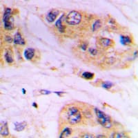 Polyclonal Rabbit anti-Human VAMP1+2+3 Antibody (Internal, IHC, WB)