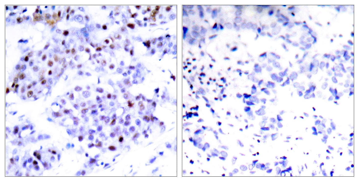 STAT6 Antibody (aa612-661)