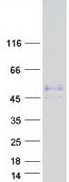 Human WTIP Protein (Recombinant Myc-DDK (Flag))