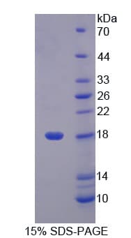Rat LCNL1 Protein (Recombinant His-T7)