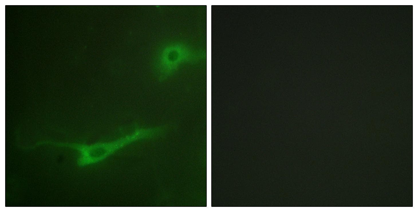 STXBP1 / MUNC18-1 Antibody (Ab-313)