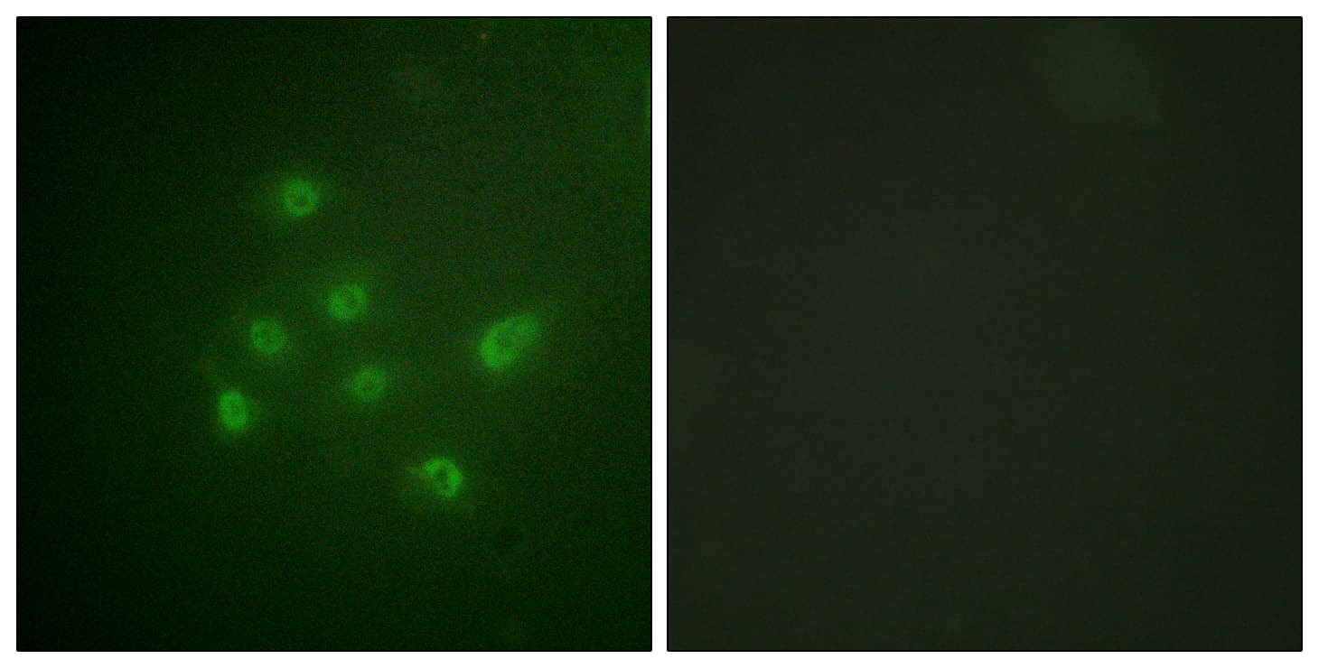 DAPK3 / ZIP Kinase Antibody (phospho-Thr265)