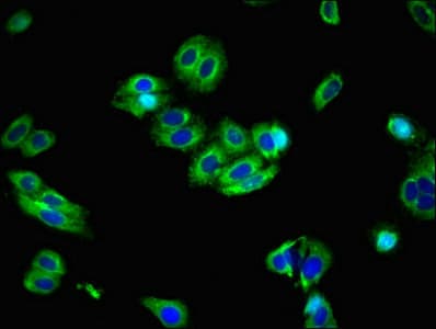 SLC39A8 / ZIP8 Antibody
