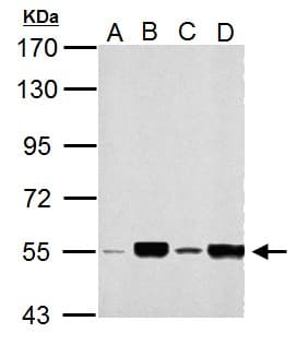 Polyclonal Rabbit anti-Human MLYCD / MCD Antibody (aa90-304, IHC, WB)