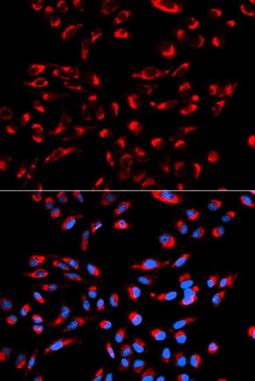 GC1qR / C1QBP Antibody