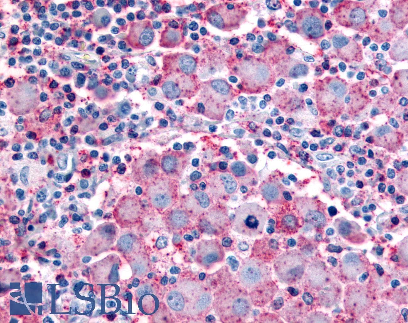 PathPlus™ Polyclonal Rabbit anti-Human WNT10A Antibody (Internal, IHC)