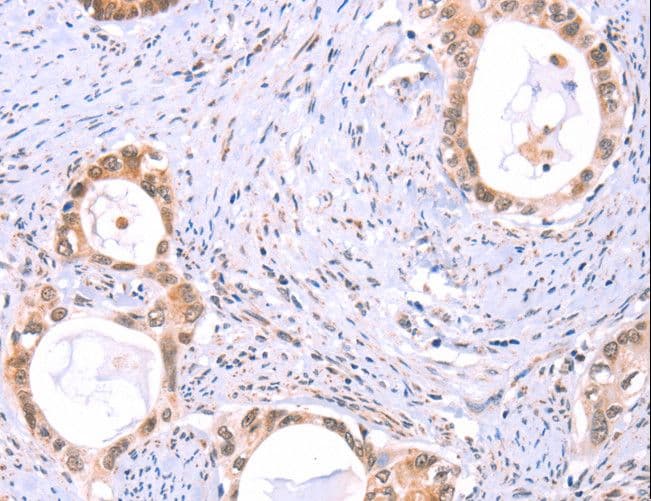 Polyclonal Rabbit anti-Human PROS1 / Protein S Antibody (IHC)