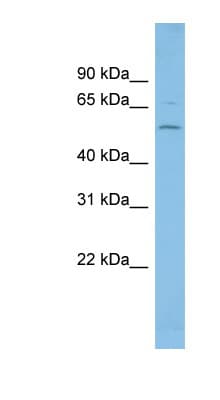 FGR Antibody (C-Terminus)