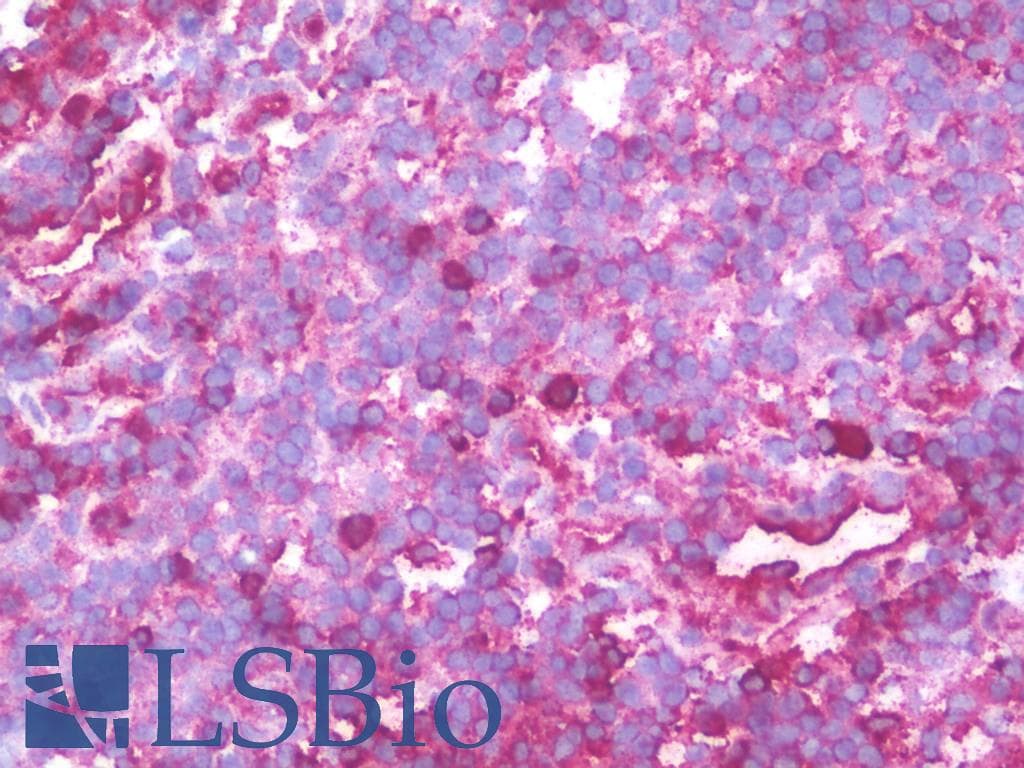 IHC-plus™ Monoclonal Mouse anti-Human PSMD10 / Gankyrin Antibody (clone 4B5, IHC, IF, WB)