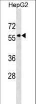 Polyclonal Rabbit anti-Human KPNA5 Antibody (aa1-30, WB)