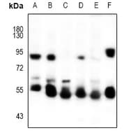 Polyclonal Rabbit anti-Human KRT5 / CK5 / Cytokeratin 5 Antibody (WB)
